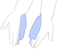 Cubital-10