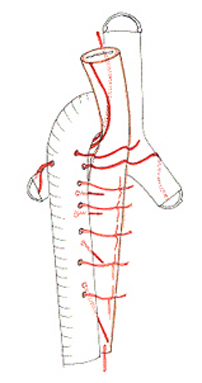 esot32'.jpg (36257 octets)