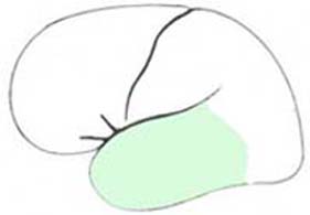 brain_ta.jpg (9922 octets)