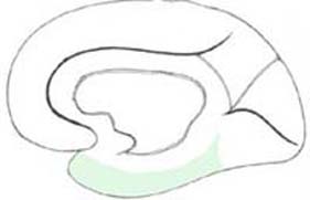 brain_tb.jpg (10362 octets)