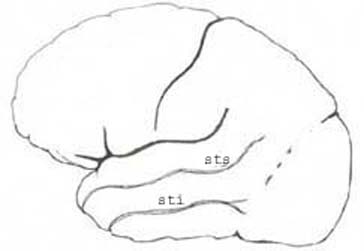 brain_tsa.jpg (12646 octets)