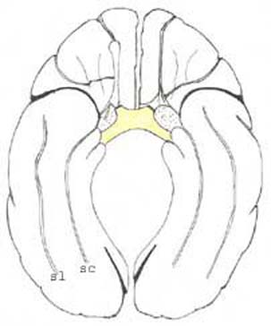 brain_tsd.jpg (15880 octets)