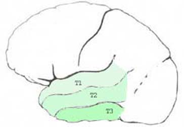 brainta.jpg (11165 octets)