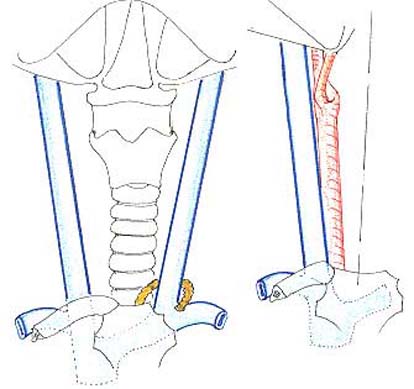 carotid27.JPG (24948 octets)