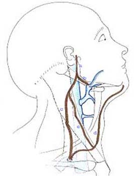 carotid28a.jpg (16399 octets)