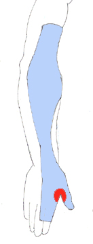 radial12.jpg (22329 octets)