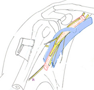 radial15.jpg (45556 octets)